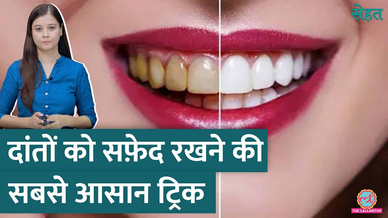 सफ़ेद, चमकते दांतों के लिए Teeth Whitening करवानी चाहिए या नहीं? | Sehat ep 964