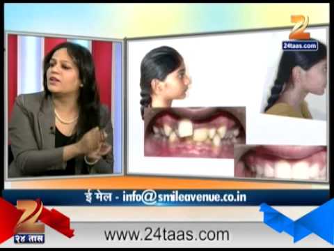 हितगुज - दंतपंक्ती दातांचे सौंदर्य
