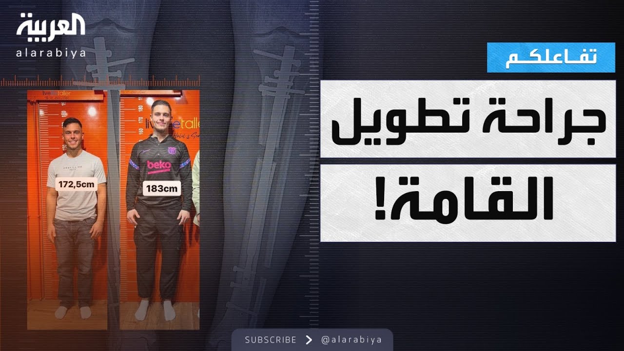 تفاعلكم | جراحة تطوّل ألماني ٢٠ سم .. ما القصة؟