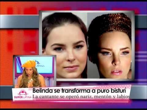 La reconstitución después de un fuerte adelgazamiento