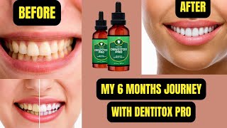 Dentitox Pro Review 2022- My 6 Months journey with Dentitox Pro
