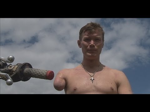 The Fastest One Armed Motocrosser in the World? 