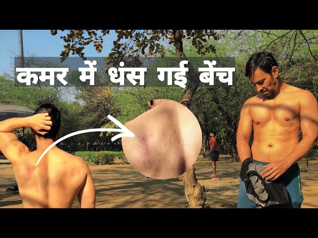 Scars on Back due to Bench | 100 Bench Press | Chest Workout | Open Gym | Body Transformation