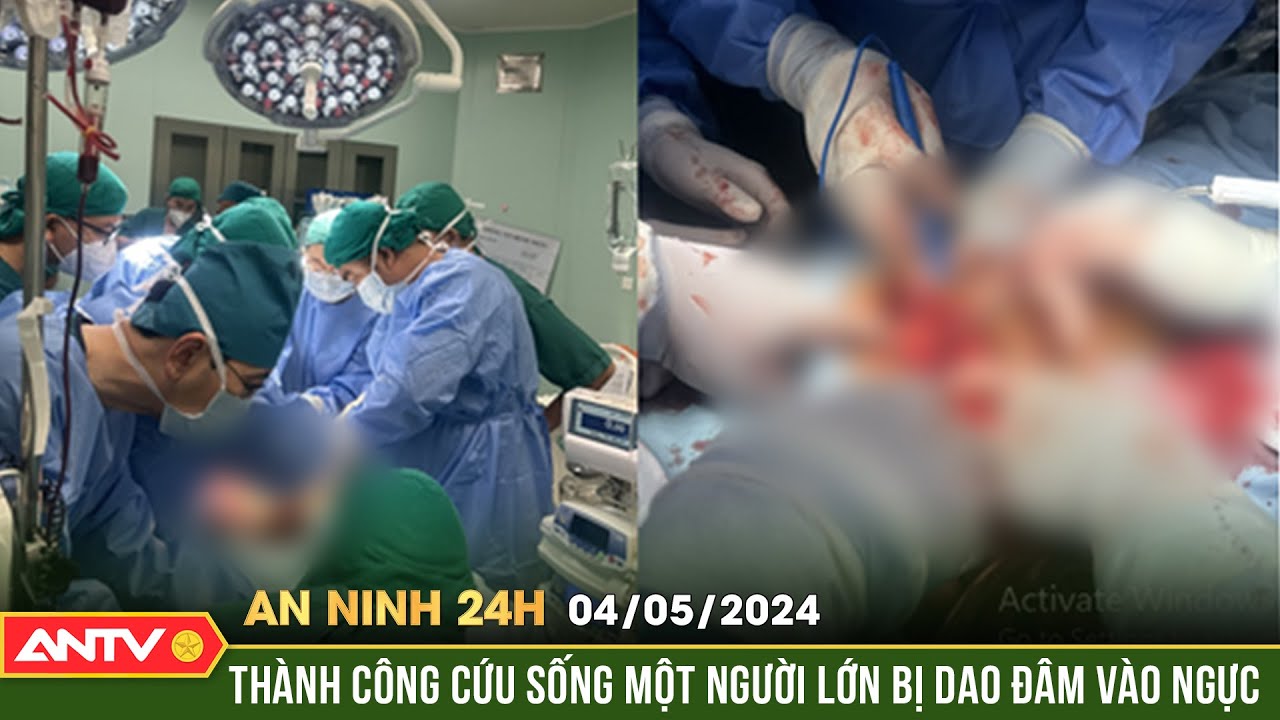 An ninh 24h ngày 4/5: Bệnh viện Nhi đồng TP. HCM cứu sống một người lớn bị dao đâm vào ngực | ANTV
