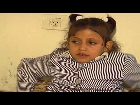 ميرا ابنة السبع سنوات من بلدة زبدة تعاني من شلل نصفي