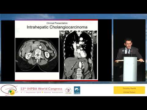 MTP17 Diagnosis and Management of Intrahepatic Cholangiocarcinoma