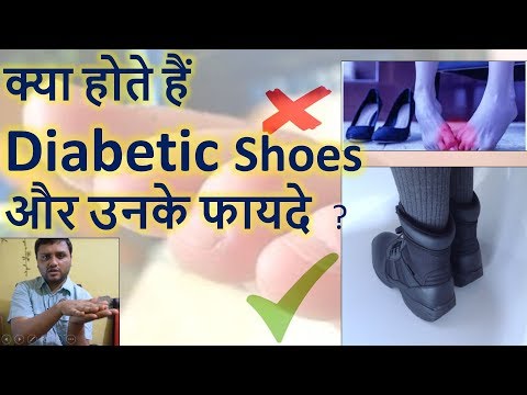 video Men’s Diabetic Shoes