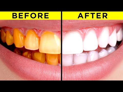 Едноставни трикови и совети за побели заби