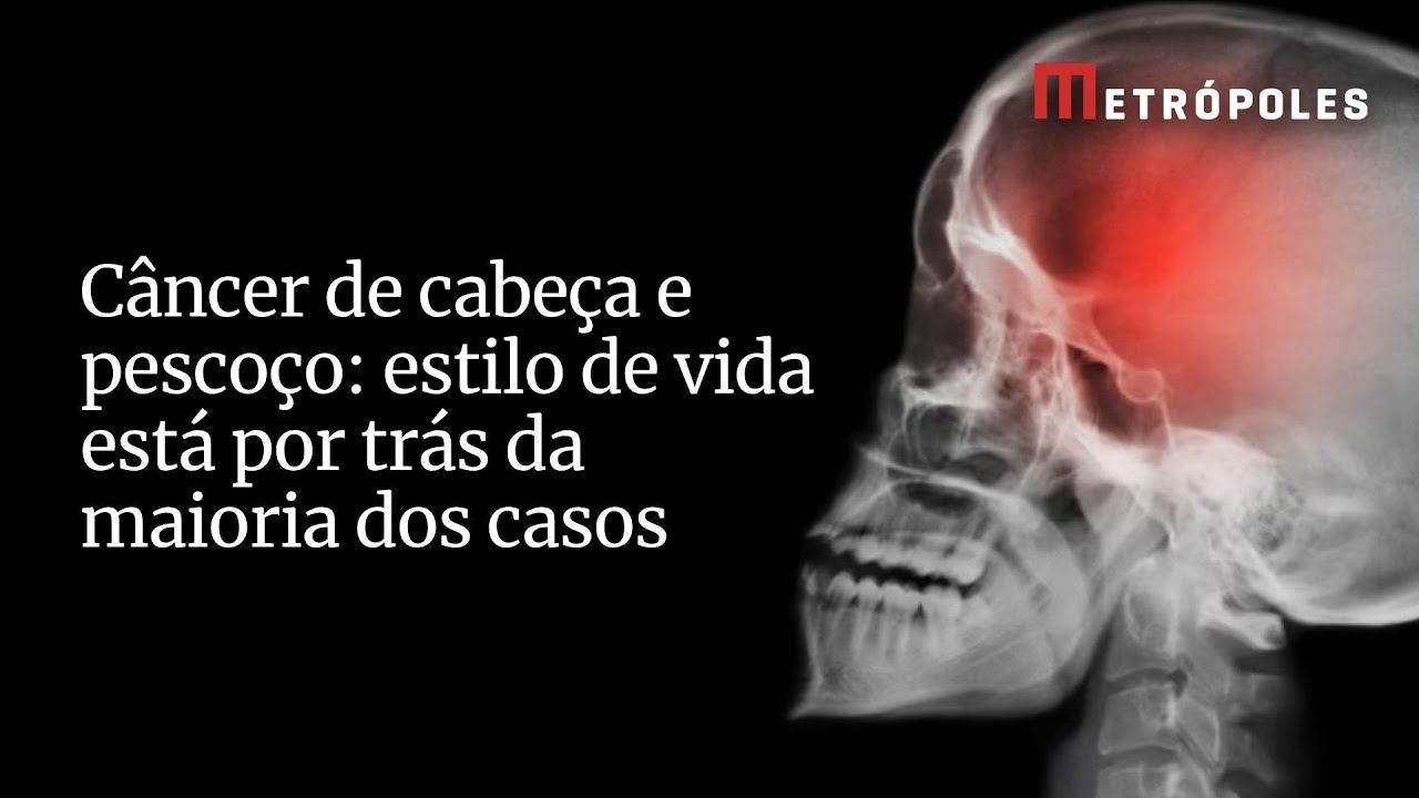 Câncer de cabeça e pescoço estilo de vida está por trás da maioria dos casos