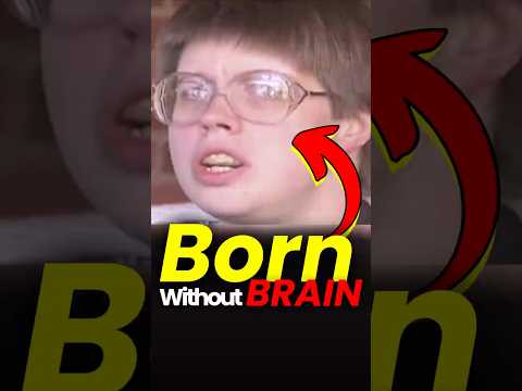 The Woman With No Cerebellum – How Did She Survive?