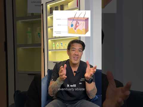 XERF vs Ultherapy