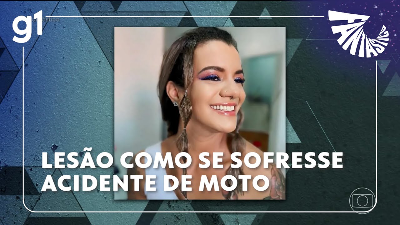 Vítima de espancamento em elevador teve lesão como se sofresse acidente de moto sem capacete