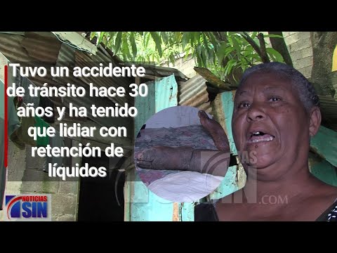 Señora pide ayuda por complicaciones de salud