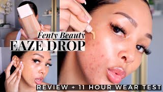 BUT DOES IT COVER ACNE?! 🤔 NEW FENTY BEAUTY SKIN TINT | Review + Wear Test
