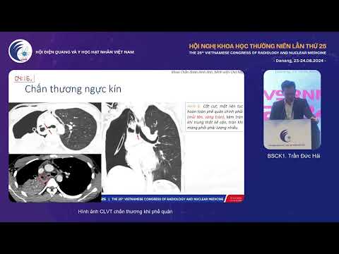 6. Hình ảnh CLVT chấn thương khí phế quản (BS.CKI. Trần Đức Hải)