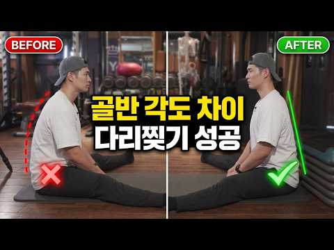 골반을 교정했더니 <strong>다리가</strong> 쫙 찢어지네요..