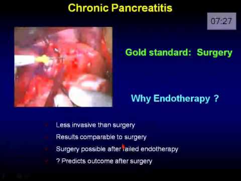 Endoscopic stenting for chronic pancreatitis 