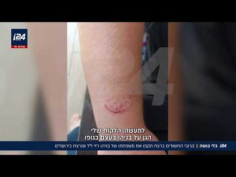 "הוא ראה הכל": עדות חברו של בניהו רזי שהיה איתו כשנרצח וסימני פטיש השניצלים על ידו | בלעדי