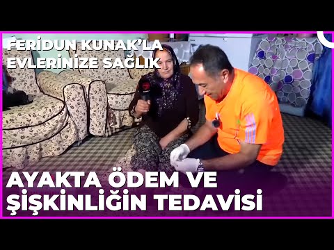 Ayakta Oluşan Ödemin Zararları Nelerdir? | Dr. Feridun Kunak’la Evlerinize Sağlık