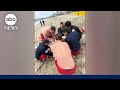 ‘Bloody all over’: Teen attacked by aggressive sea lion
