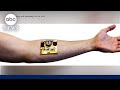 Smart bandages aim to improve healing and medical intervention