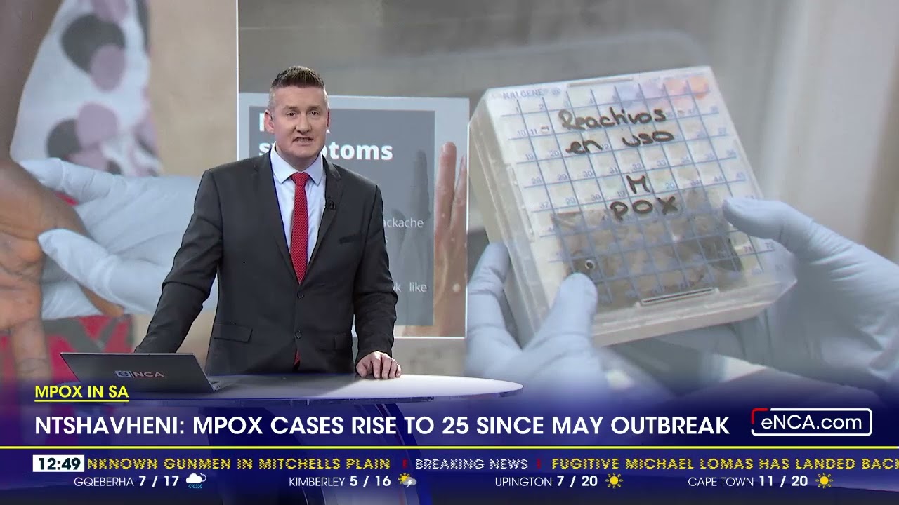 Mpox In SA | Mpox cases rise to 25 since May outbreak