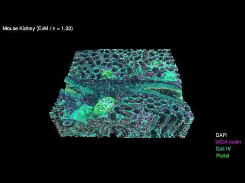 Upload mp3 to YouTube and audio cutter for Alpenglow images mouse kidney using expansion microscopy download from Youtube