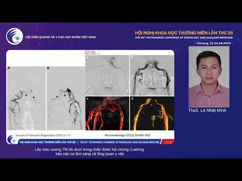 4. Lấy máu xoang TM đá dưới trong chẩn đoán hội chứng Cushing (ThS. Lê Nhật Minh)