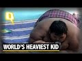Shocker Alert: World’s Heaviest Indonesian Kid Put On a Crash Diet