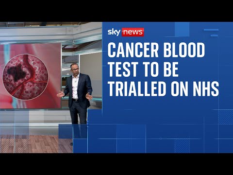 Cancer blood test to be trialled on NHS