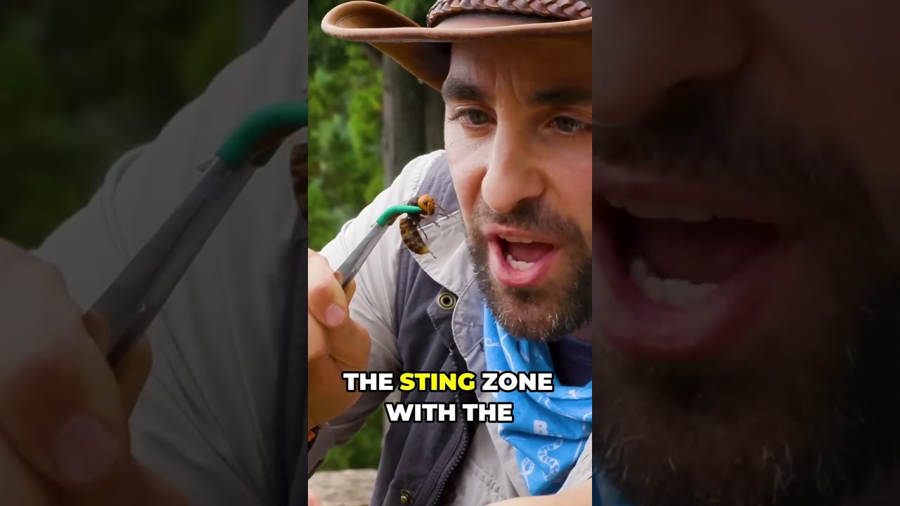 Murder Hornet Sting
