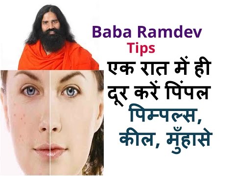 एक रात में ही दूर करें पिंपल Baba Ramdev Tips Remove Pimple In One Night in Hindi