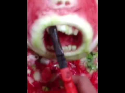 이빨뽑기ㅋㅋㅋㅋㅋㅋㅋ