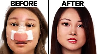 Surgeon Reacts to I Got Plastic Surgery And I Regret It