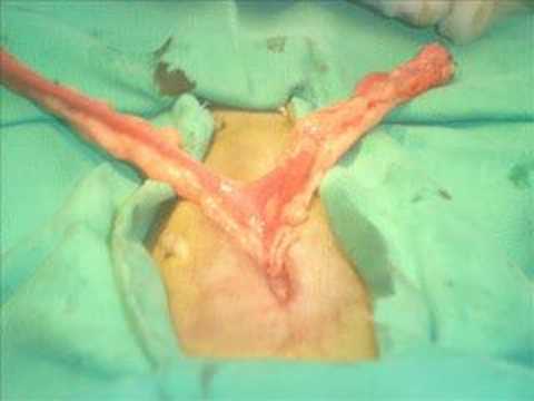 Ovarihisterektomija kuje 