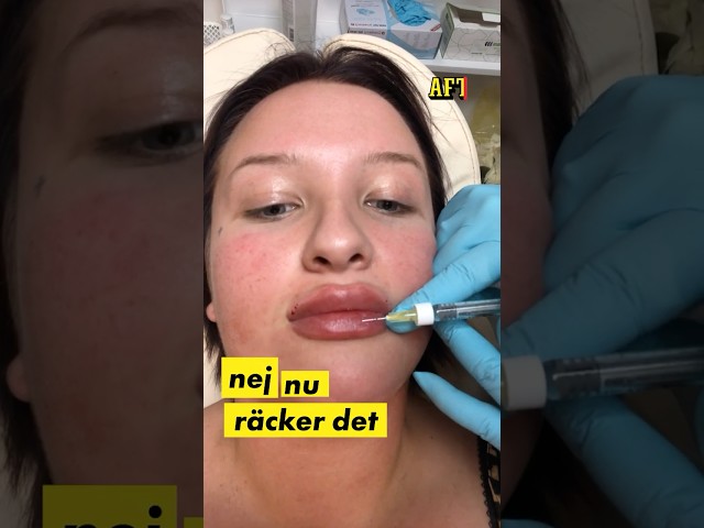Linnéa, 23: ”Jag blev blind, jag ville ha mer”