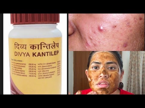 Patanjali Divya Kantilep face pack honest review & demo for pimples dark spot | How to use in Hindi