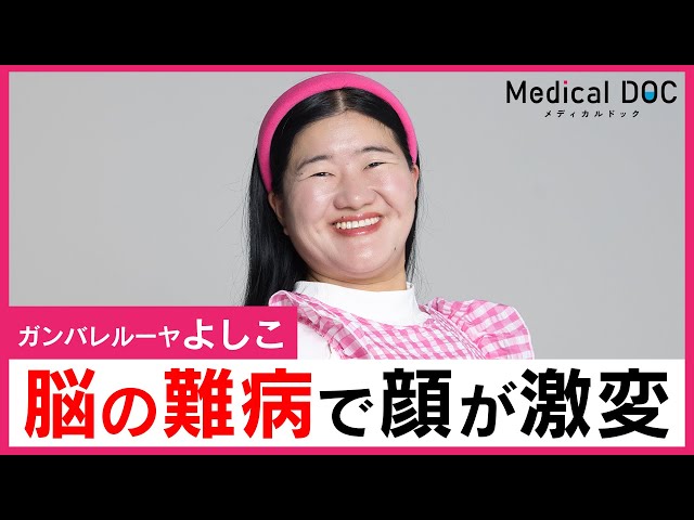 ガンバレルーヤよしこ、先端巨大化する「難病」の発覚。“視力喪失”の恐怖とは【闘病】