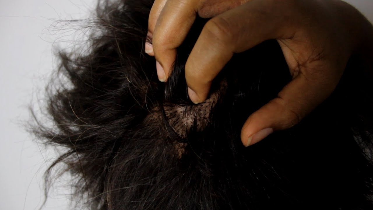 the-reasons-why-you-have-an-itchy-dry-scalp-youtube