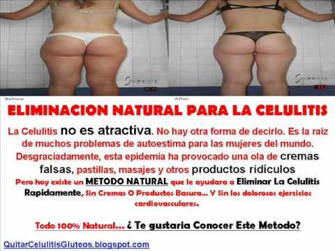 remedios para quitar la celulitis rapido