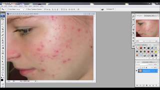 ازالة الحبوب والشوائب من الصور فوتوشوب spot healing brush tool