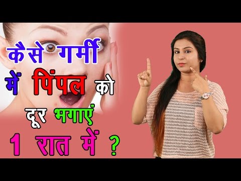 कैसे गर्मी में पिंपल को दूर भगाएं 1 रात में ? How To Remove Pimples, Acne & Dark Spots - Home Remedy