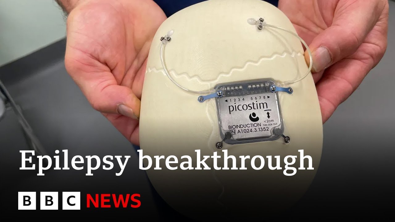 World's first epilepsy device fitted in boy's skull | BBC News