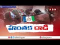 అప్పుడు ముద్దులు - ఇప్పుడు గుద్దులు జగన్ మోహన్ రెడ్డి ఇదేనా నీ పాలన | ABN Telugu  - 01:46 min - News - Video