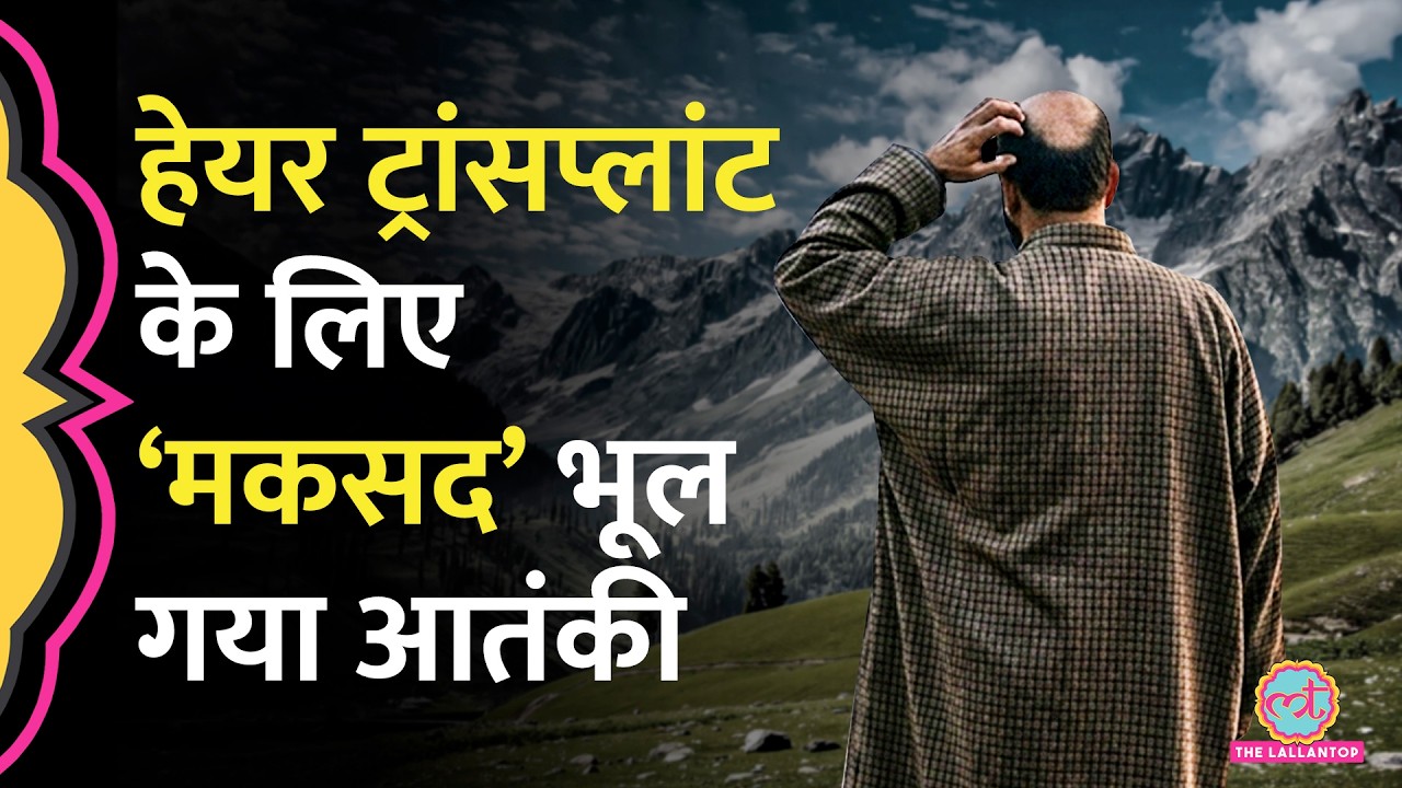 Pakistan से आया Lashkar आतंकी, मिशन छोड़ करवाने लगा Hair Transplant, NIA की जांच में खुलासा