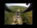 sortie vtt Sangatte / Mont de couple 17 04 2014