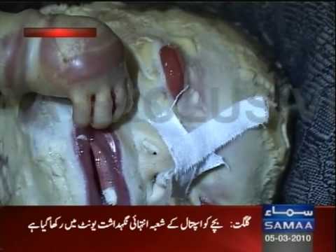 Human tiger baby birth in Pakistan.mpg - YouTube