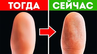 Поврежденные отпечатки пальцев восстанавливают тот же самый узор и другие факты о теле