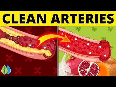 ??Top 7 Foods that Unclog Arteries Naturally and Prevent Heart Attack