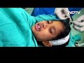 Delhi AIIMS में 5 साल बच्ची को बिना बेहोश किए की गई Brain Tumour Surgery - 02:13 min - News - Video
